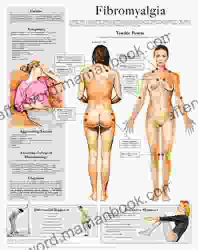 Fibromyalgia E Chart: Full Illustrated